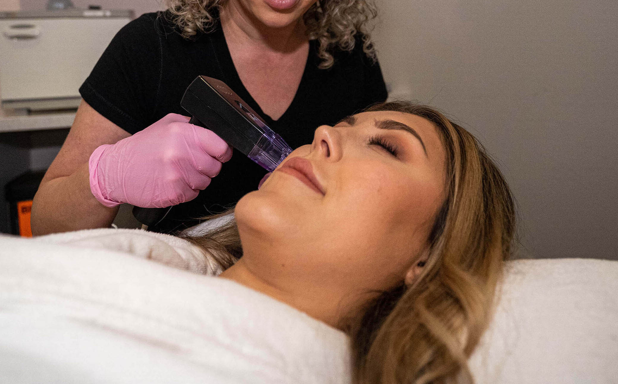 Microneedling St Petersburg Florida